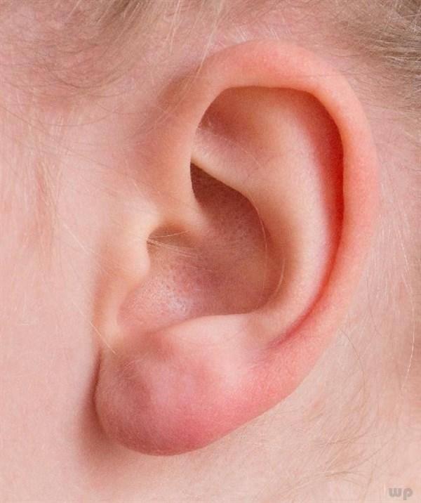 耳朵疼痛是什么原因(耳朵疼最简单止痛方法)