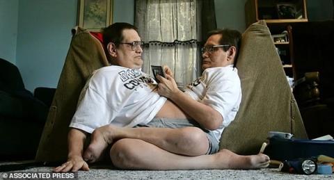 腹部相连只能轮流睡觉：世界最长寿男性连体双胞胎68岁同时去世
