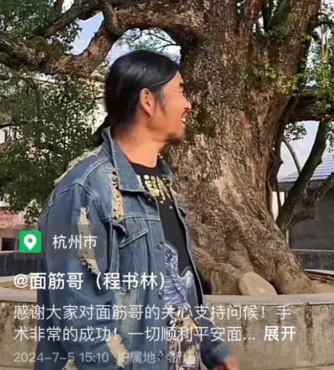 面筋哥现在的现状!手术成功已经苏醒，具体情况是什么？-趣考网