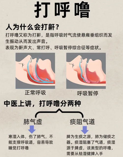 打呼噜是什么原因引起的-图1