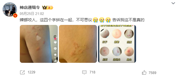 “蟑螂咬人”上热搜 《博物杂志》分析辟谣：三种可能-图1