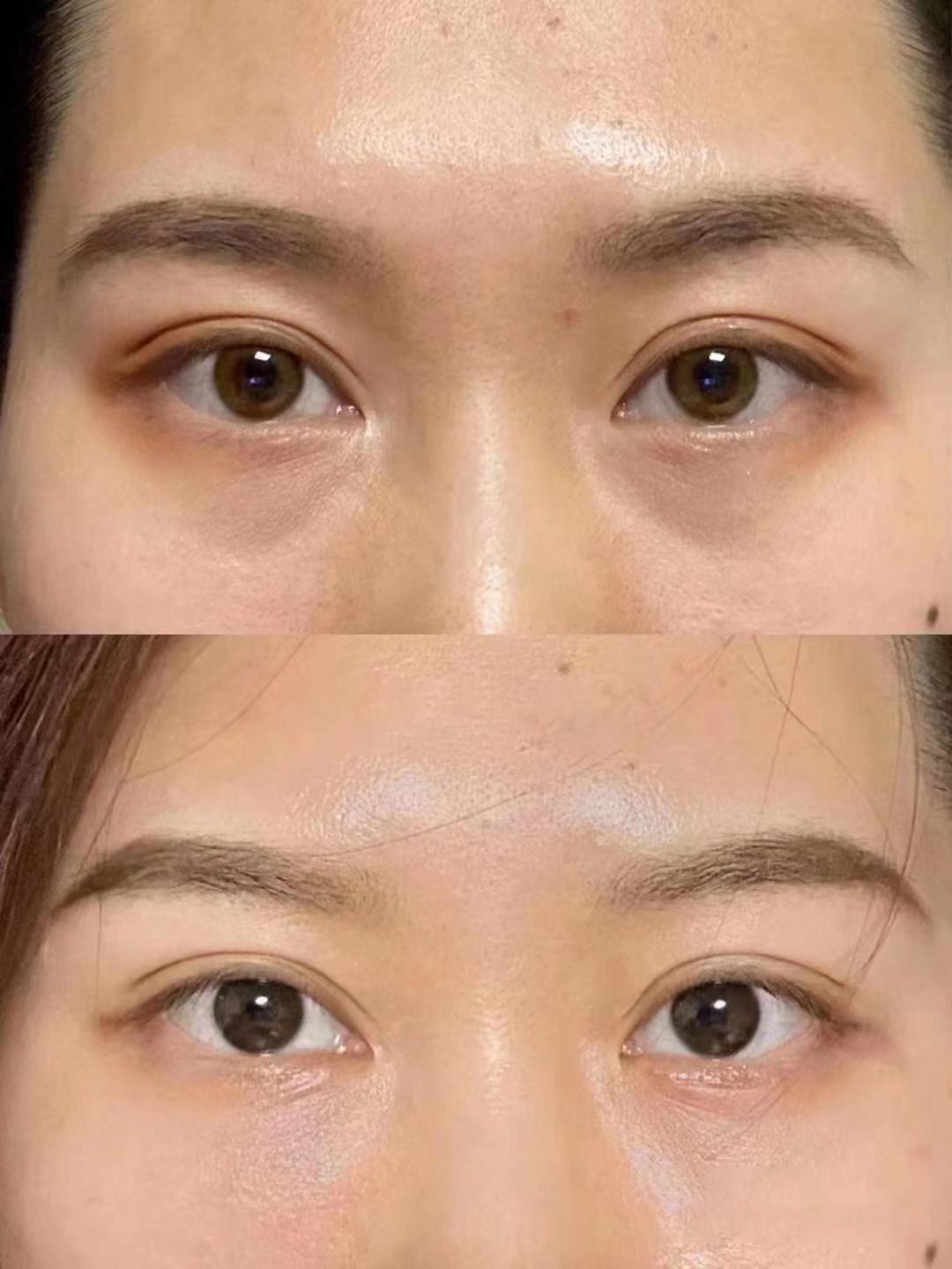 眼霜哪个品牌效果最好？详细测评八款眼霜，最强眼霜品牌盘点推荐-图4