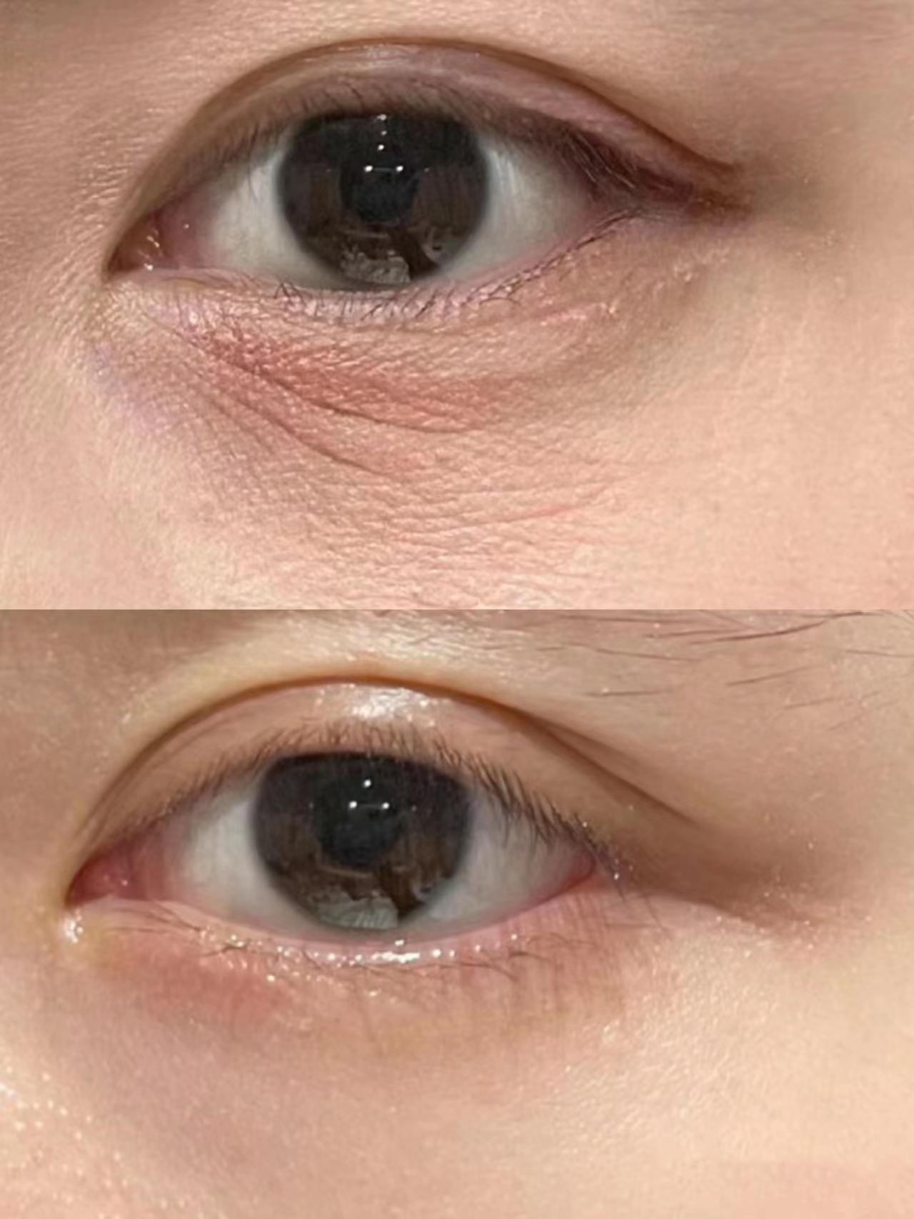 抗老眼霜哪个牌子好？眼部年轻秘诀公开，科学抗老眼霜测评推荐-图4