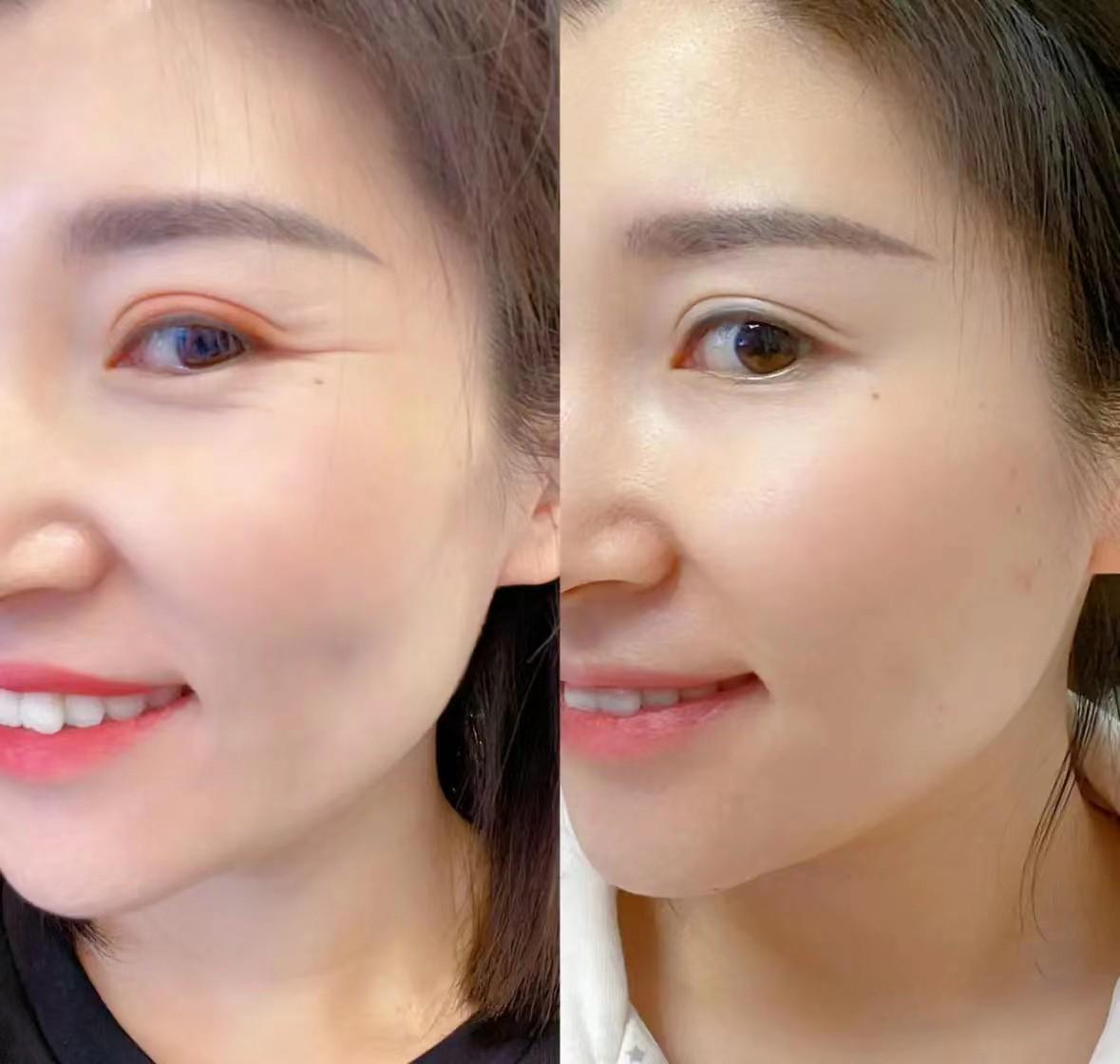 什么眼霜去皱效果好？眼部分层抗衰攻略，值得信赖的十大眼霜品牌-图5
