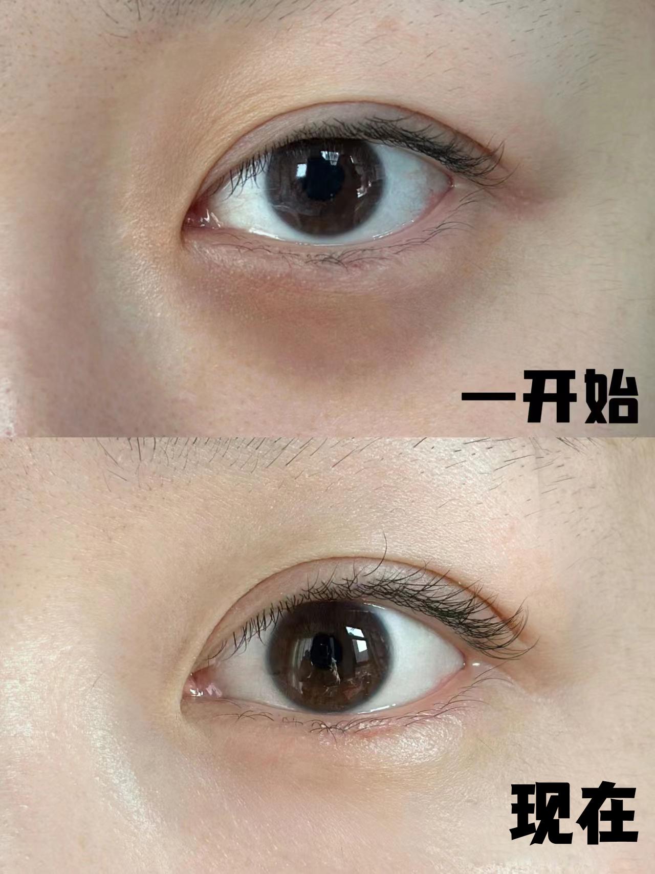 抗皱眼霜哪个牌子好？抗皱眼霜公认好用的品牌，眼霜的成分和功效-图4