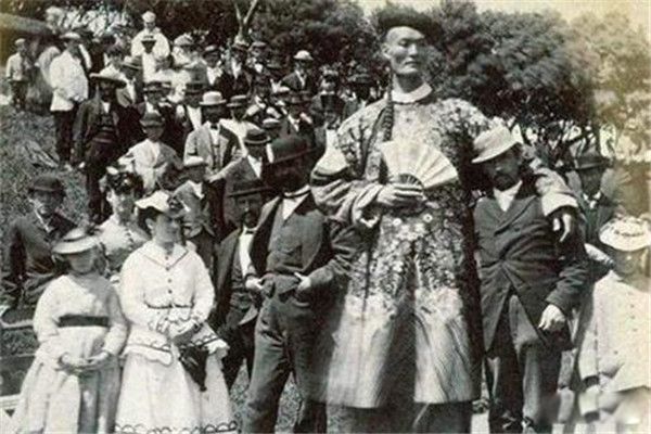 世界之最的人有哪些 这五个人身高如此巨大的原因-图1