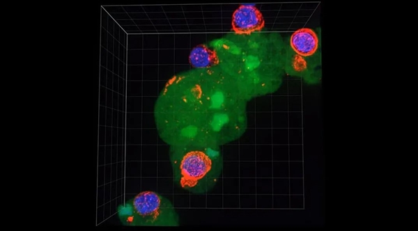这种每年感染5000万人的寄生虫：科学已经知道它对人体做了什么-图5