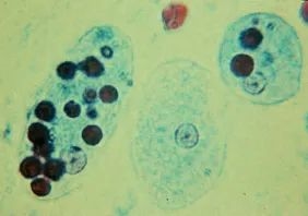 这种每年感染5000万人的寄生虫：科学已经知道它对人体做了什么-图6