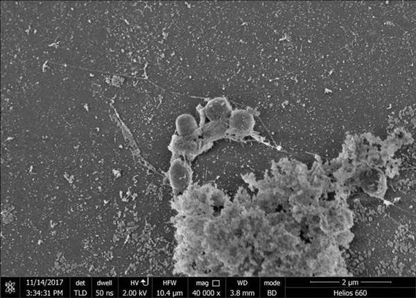 地球上明明有吃塑料的虫子 为什么没有普及-图1 地球上明明有吃塑料的虫子 为什么没有普及-图1