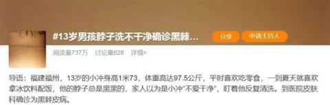 脖子总是黑黑的洗不干净 这可能是身体在“求救”(图1)