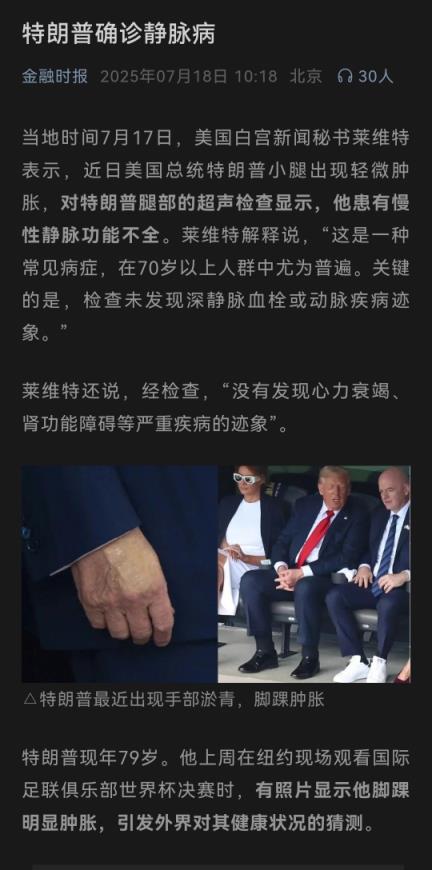特朗普确诊静脉病