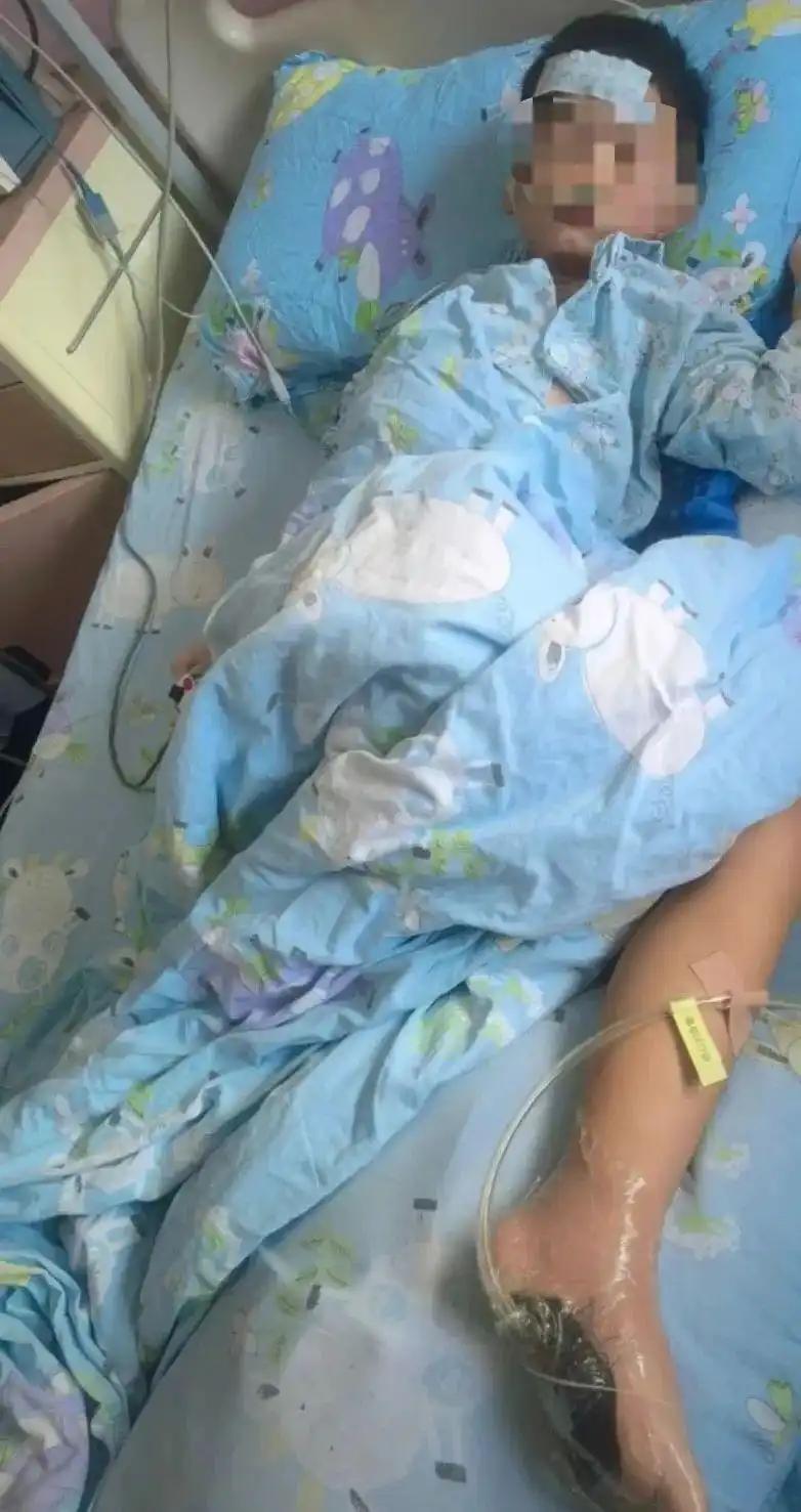 6岁娃光脚踩到死鱼进了ICU?家属回应