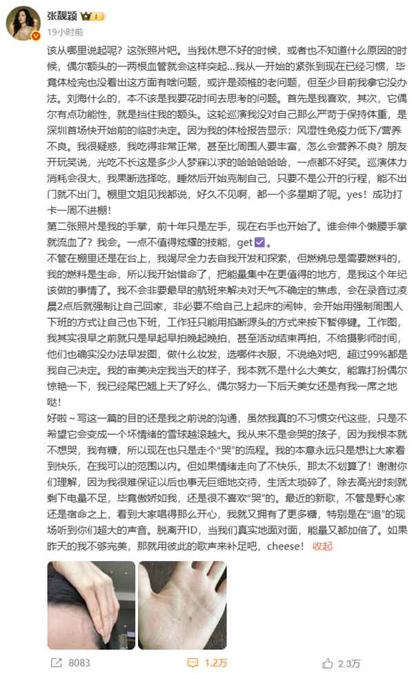张靓颖自曝体检查出营养不良：额头血管莫名突起 伸懒腰手掌就流血(图3)