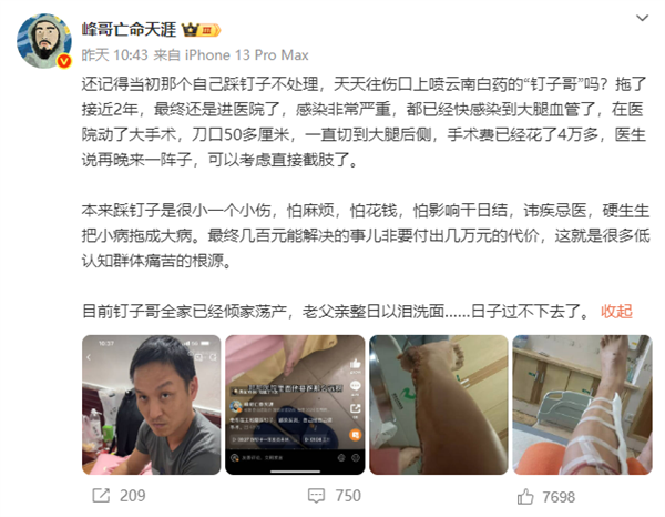 男子2年前踩钉子未就医 只用自来水洗伤口喷药:面临截肢风险!-图1 男子2年前踩钉子未就医 只用自来水洗伤口喷药:面临截肢风险!-图1