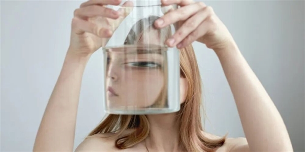 荷兰女子患罕见疾病 看到的人脸会扭曲为龙脸-图2 荷兰女子患罕见疾病 看到的人脸会扭曲为龙脸-图2