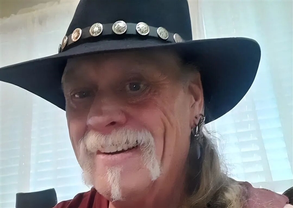 荷兰女子患罕见疾病 看到的人脸会扭曲为龙脸-图5 荷兰女子患罕见疾病 看到的人脸会扭曲为龙脸-图5