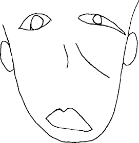 荷兰女子患罕见疾病 看到的人脸会扭曲为龙脸-图9 荷兰女子患罕见疾病 看到的人脸会扭曲为龙脸-图9