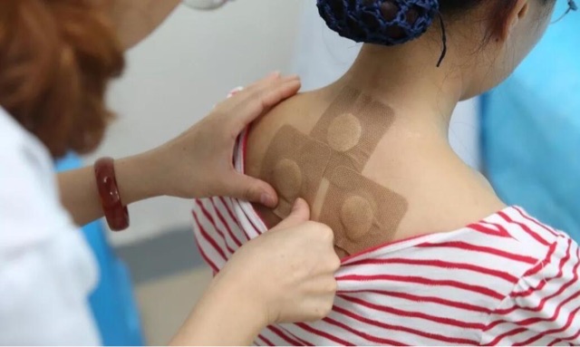 三伏贴有什么功效?贴三伏贴有什么注意事项?-图2 三伏贴有什么功效?贴三伏贴有什么注意事项?-图2