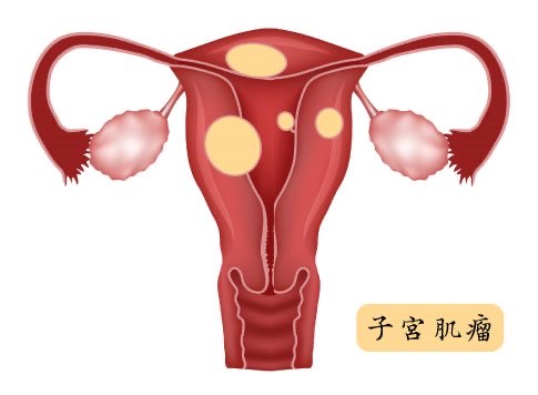 四物汤的功效与作用及食用方法?这些禁忌要注意-图3 四物汤的功效与作用及食用方法?这些禁忌要注意-图3