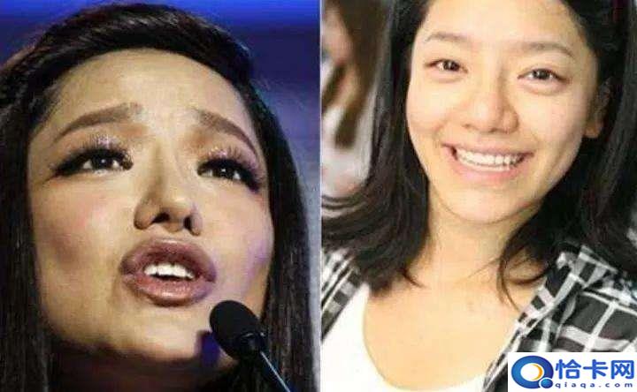 angelababy整容前?baby为证零整容都做过什么-图1 angelababy整容前?baby为证零整容都做过什么-图1