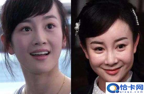 angelababy整容前?baby为证零整容都做过什么-图2 angelababy整容前?baby为证零整容都做过什么-图2