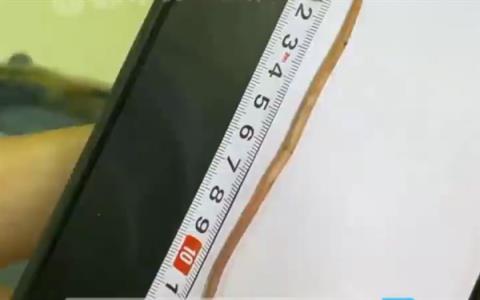 11岁男孩感染寄生虫瘦到15公斤：治疗排出一条13厘米长蛔虫(图1)