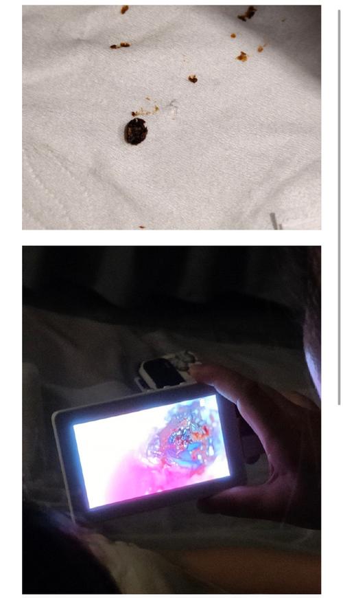 爸爸掏耳朵被孩子撞到致耳膜脱落