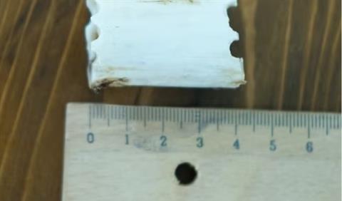 太疯狂！嫌个子太高不好找对象 女子手术切骨变矮(图4)