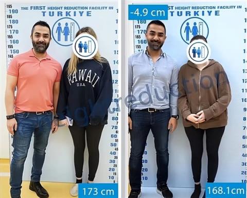 太疯狂！嫌个子太高不好找对象 女子手术切骨变矮(图5)