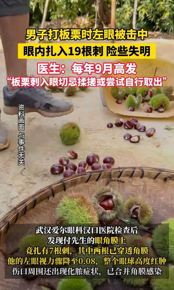 男子打板栗:左眼扎入19根刺险失明-图2 男子打板栗:左眼扎入19根刺险失明-图2