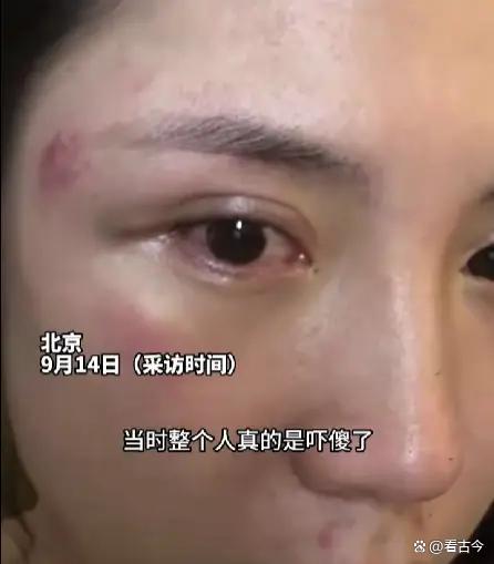 北京冰雹砸伤女子?两大哥冲上前护送暖心护花?恶劣天气如何保平安?