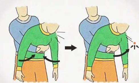 日常医用小知识？常见的家庭急救知识