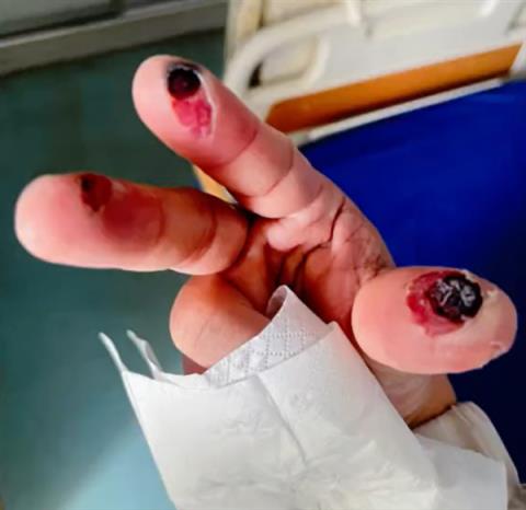 女子误踩身亡！警惕清洁剂中隐藏的“化骨水” 你家可能也有