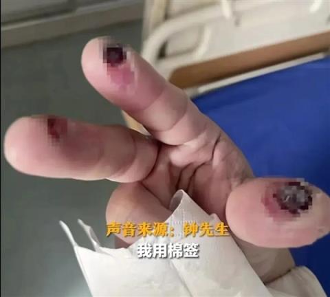一次意外接触就不幸身亡！国家应急广播：警惕身边这些化学品(图2)