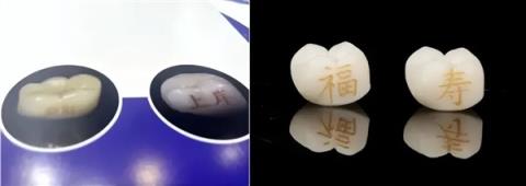 “发财”“上岸”刻牙上 牙齿上刻字成新玄学！专家：不建议(图3)