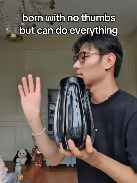男子天生缺少拇指 用4指开瓶盖喝水走红-图1 男子天生缺少拇指 用4指开瓶盖喝水走红-图1