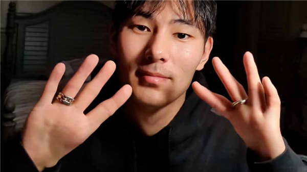 男子天生缺少拇指 用4指开瓶盖喝水走红-图5 男子天生缺少拇指 用4指开瓶盖喝水走红-图5