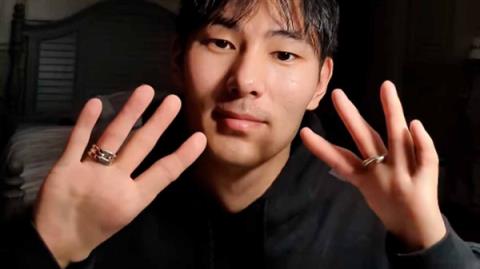男子天生缺少拇指 用4指开瓶盖喝水走红(图5)