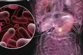 为什么抗菌药物对胃有刺激？抗菌药物知多少？使用需慎重！