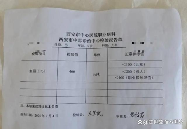 网红护肤法让6个月宝宝血铅飙至700!医生警告:智力损伤或不可逆