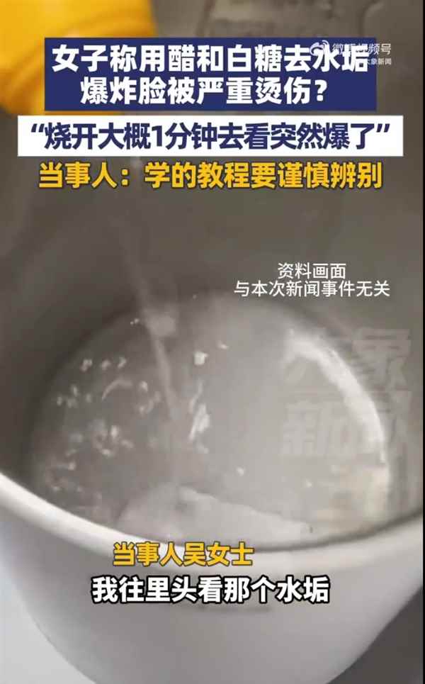 女子用醋加白糖去水垢致爆炸烫伤 当事人：烧开大概1分钟爆了 学的网上教程(图1)