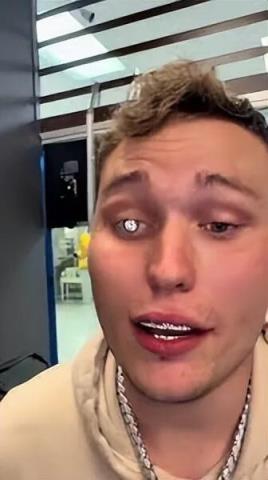 走在路上怕被抢 美国男子定制最昂贵义眼!成本200万美元(图4)