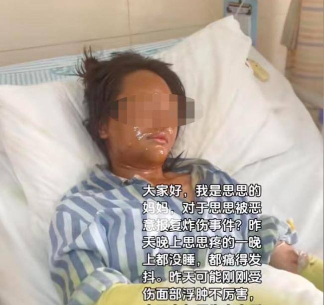 被炸伤女主播拒绝受害者有罪论 反击网络偏见