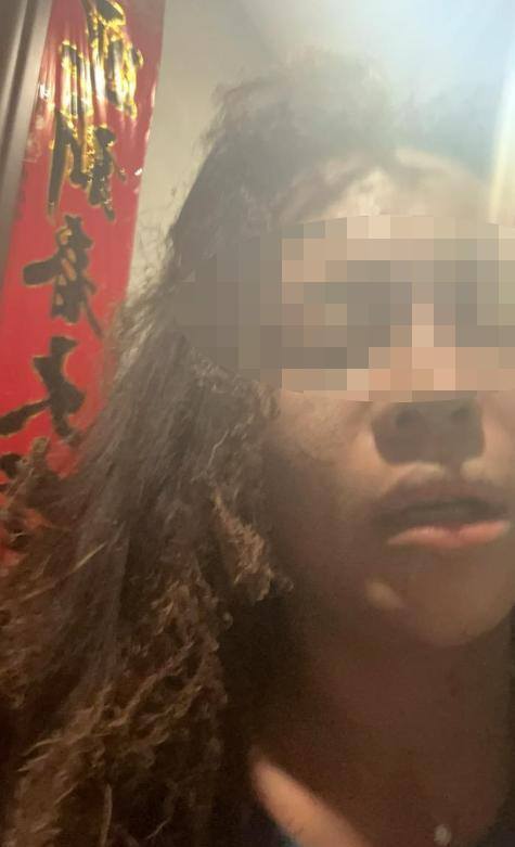 被炸伤女主播拒绝受害者有罪论 反击网络偏见