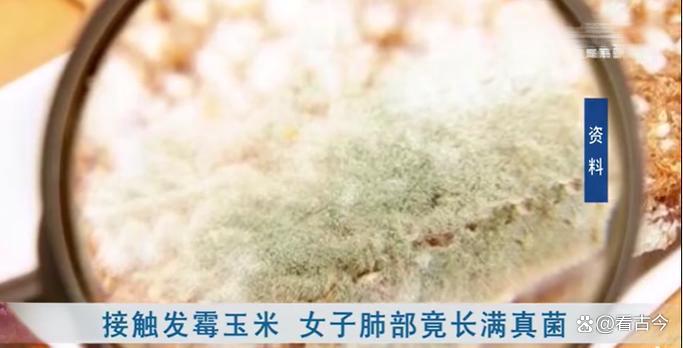 发霉玉米竟成肺部“杀手”?女子接触后肺部全白