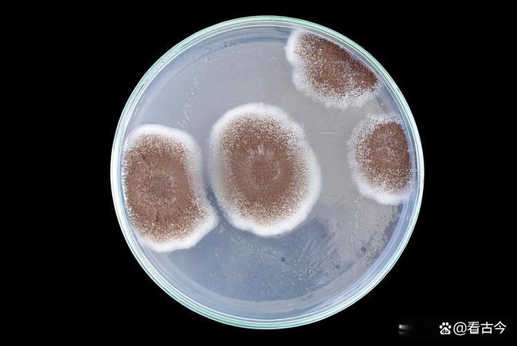 发霉玉米竟成肺部“杀手”?女子接触后肺部全白