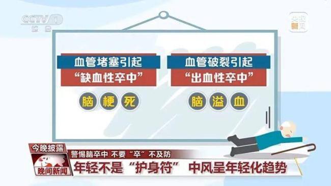 年轻人脑卒中发病率逐步增加 警惕生活方式因素