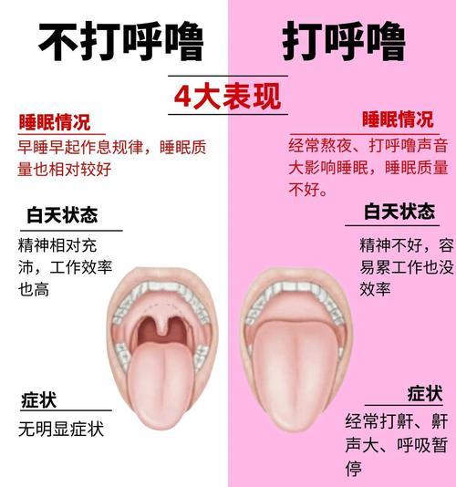 女性呼吸道结构、生活习惯与睡姿都可能导致打呼噜？女性呼吸道结构