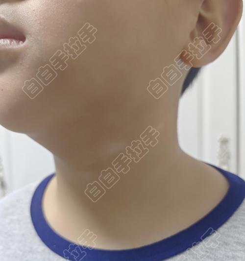 如何恢复少年白的健康？掌握正确方法