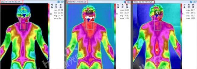 一张体检单,为何成了大学生涯的“终止符”? 色弱引发录取风波